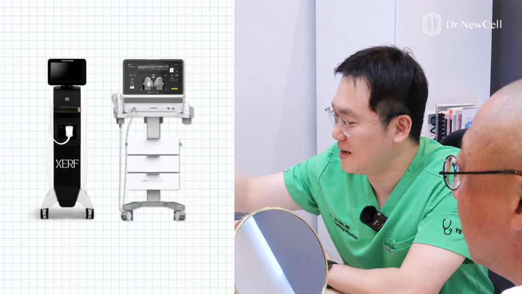 The Ultimate Ultrasound RF Combination : Ultherapy Prime and XERF