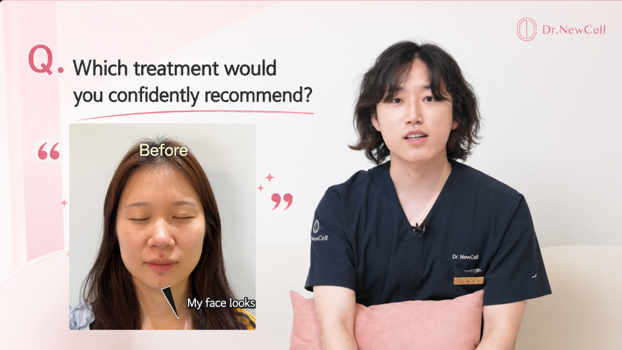Doctor explain about face lifting treatment