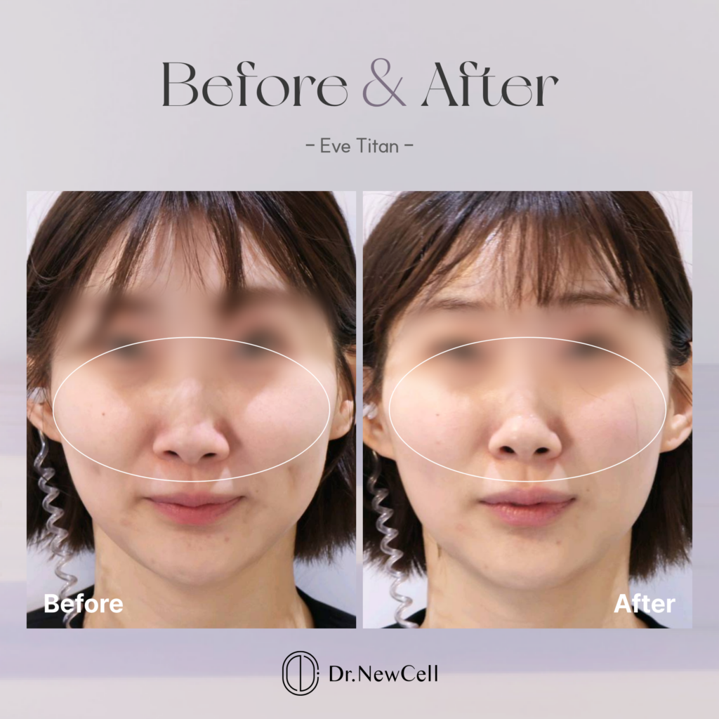 260714_홈페이지 B&A_01