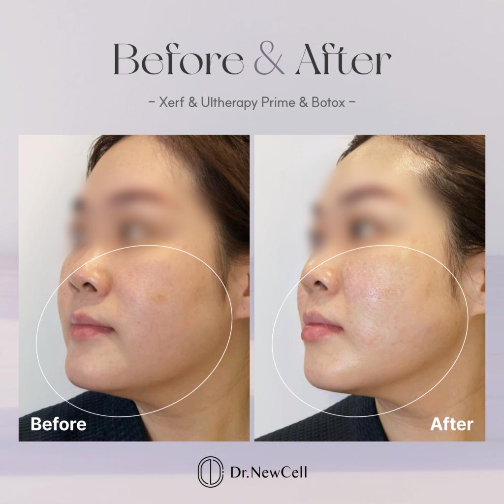 260714_홈페이지 B&A_05