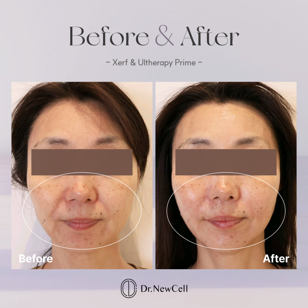260723_홈페이지 B&A