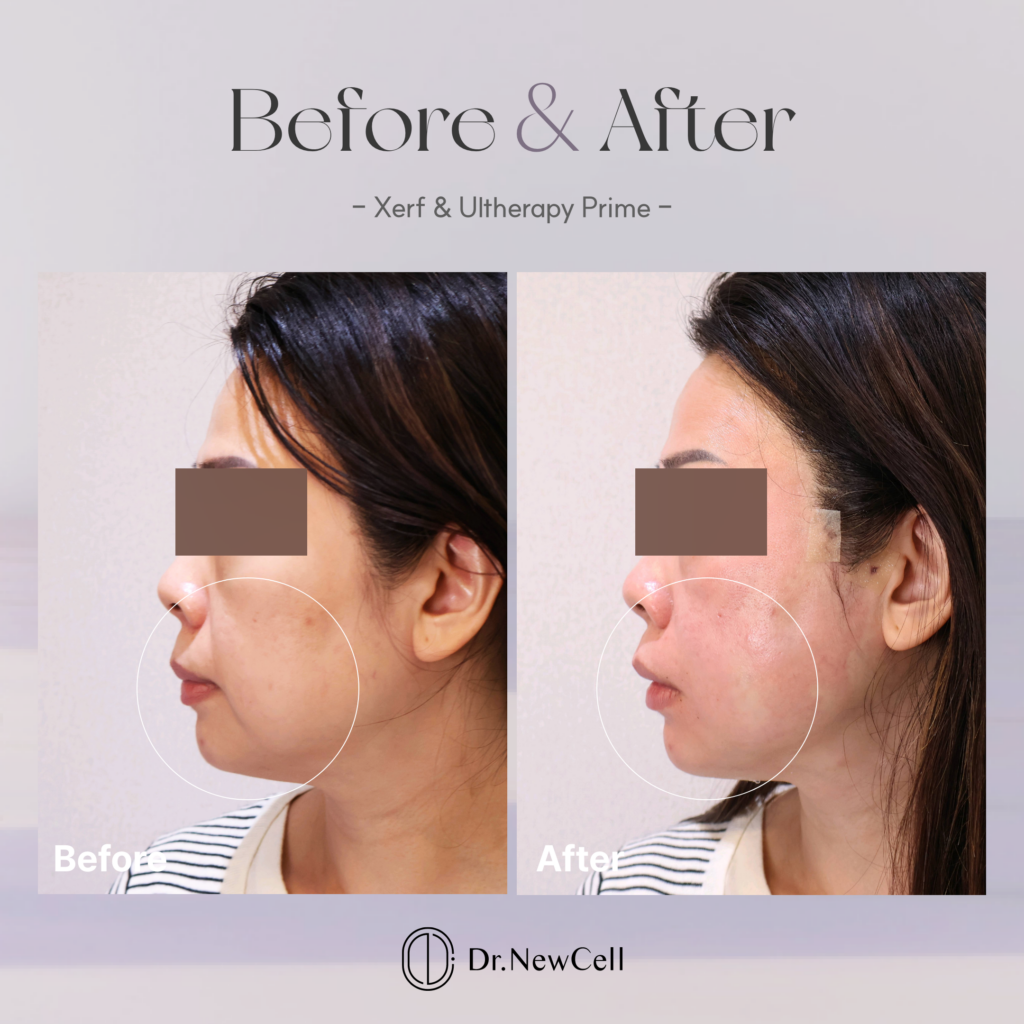 260805_홈페이지 B&A_02