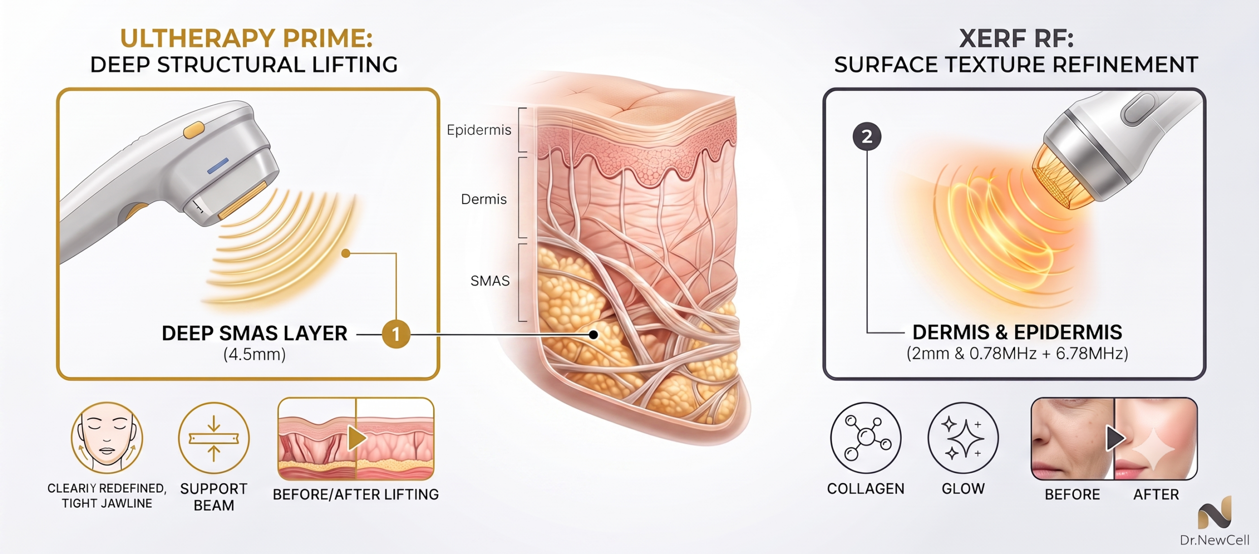Same-Day Multi-Layer Face Lifting in Gangnam for Travelers