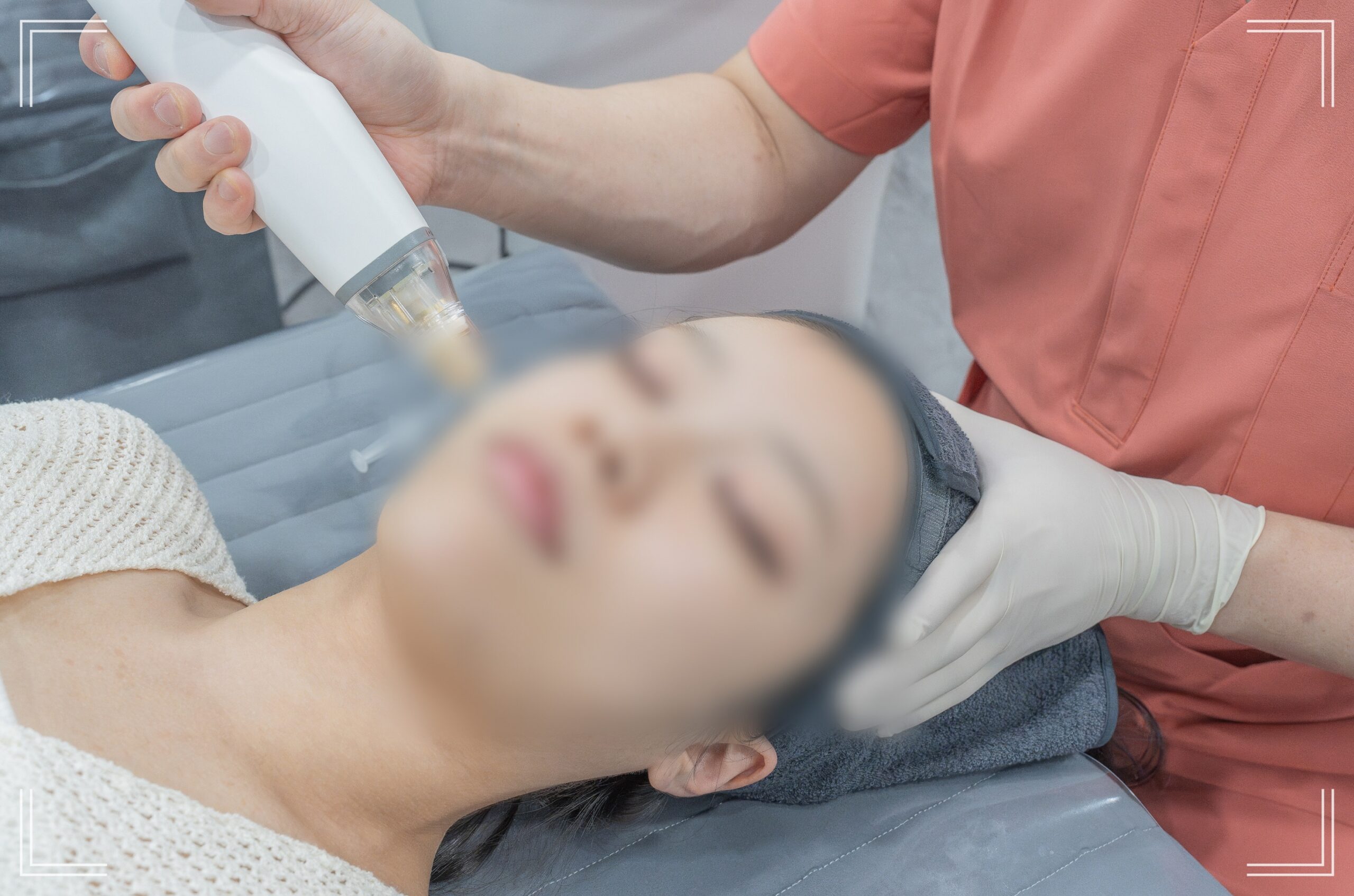 모공 줄이는 시술 장면, 닥터뉴셀의원의 포텐자 쥬베룩 조합