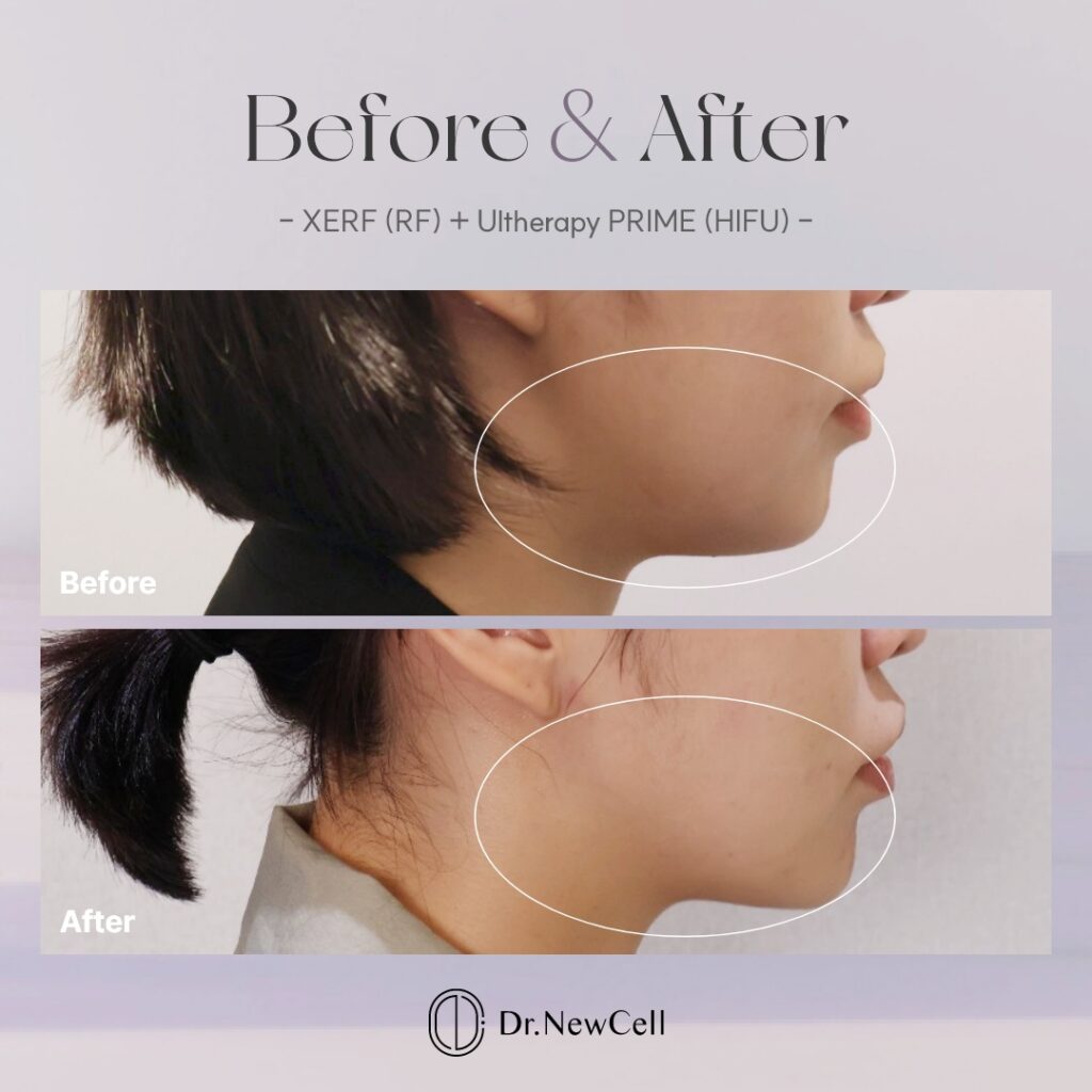 260903_홈페이지 B&A_01