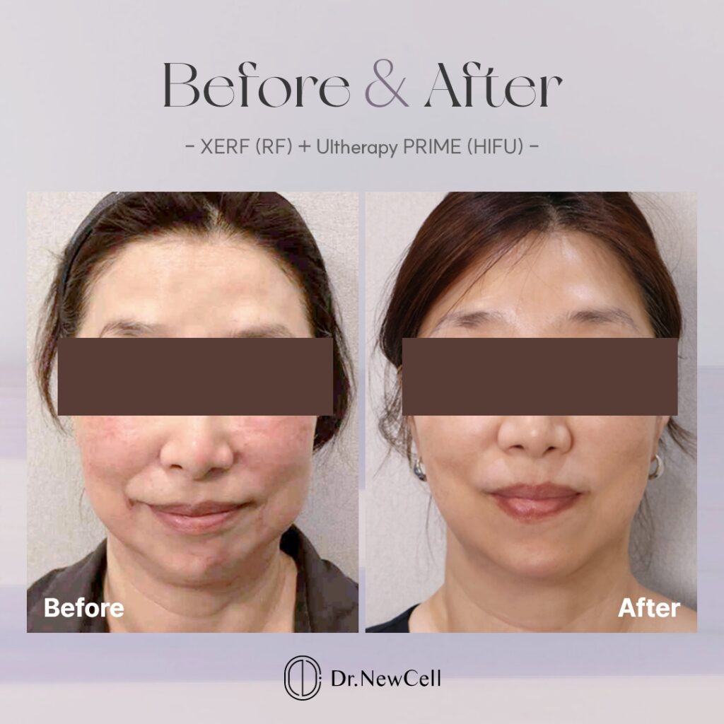 260903_홈페이지 B&A_03