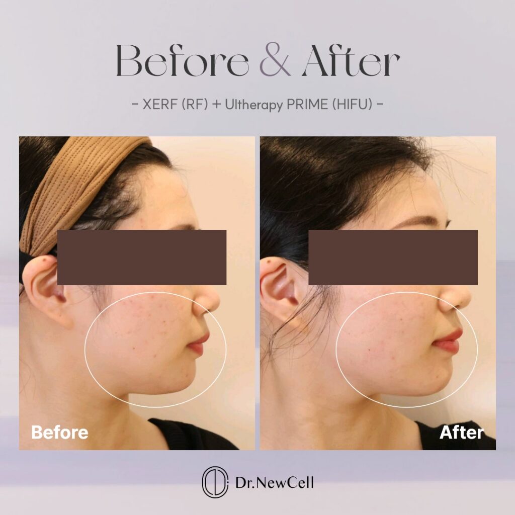 260903_홈페이지 B&A_05