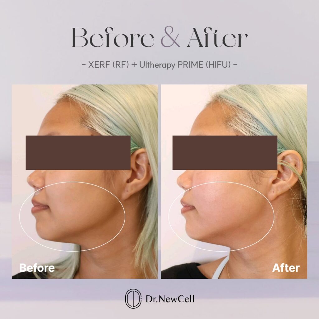 260903_홈페이지 B&A_06