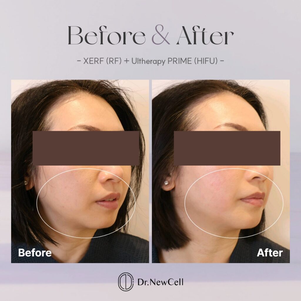 260903_홈페이지 B&A_07