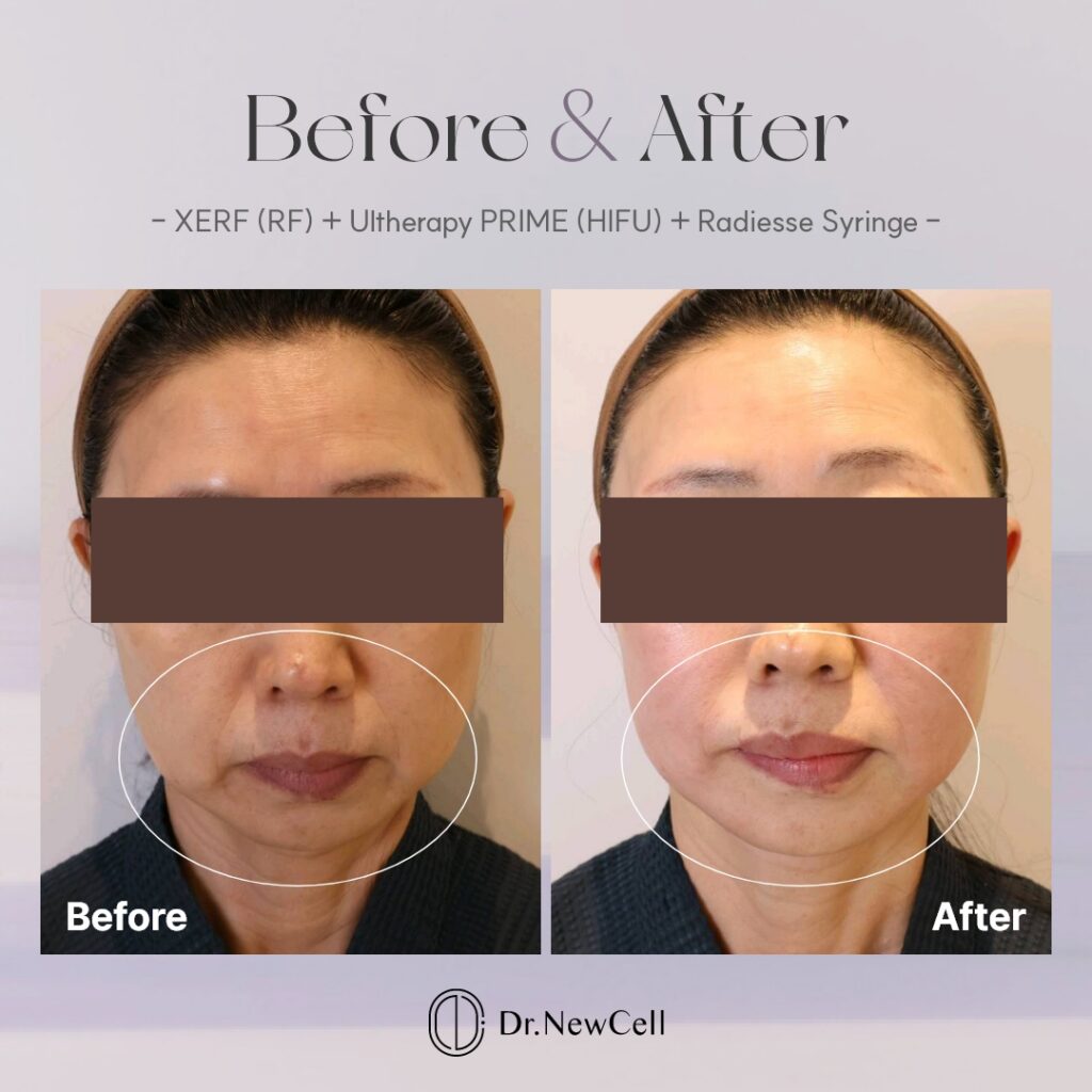 260914_홈페이지 B&A_01