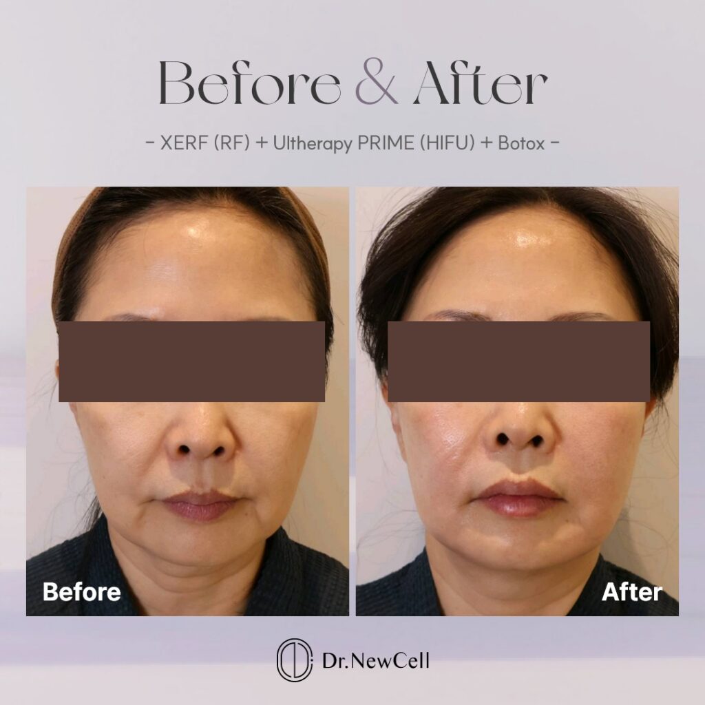 260914_홈페이지 B&A_02