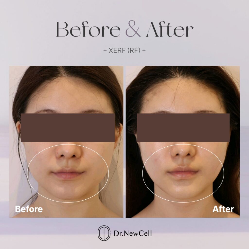260914_홈페이지 B&A_03
