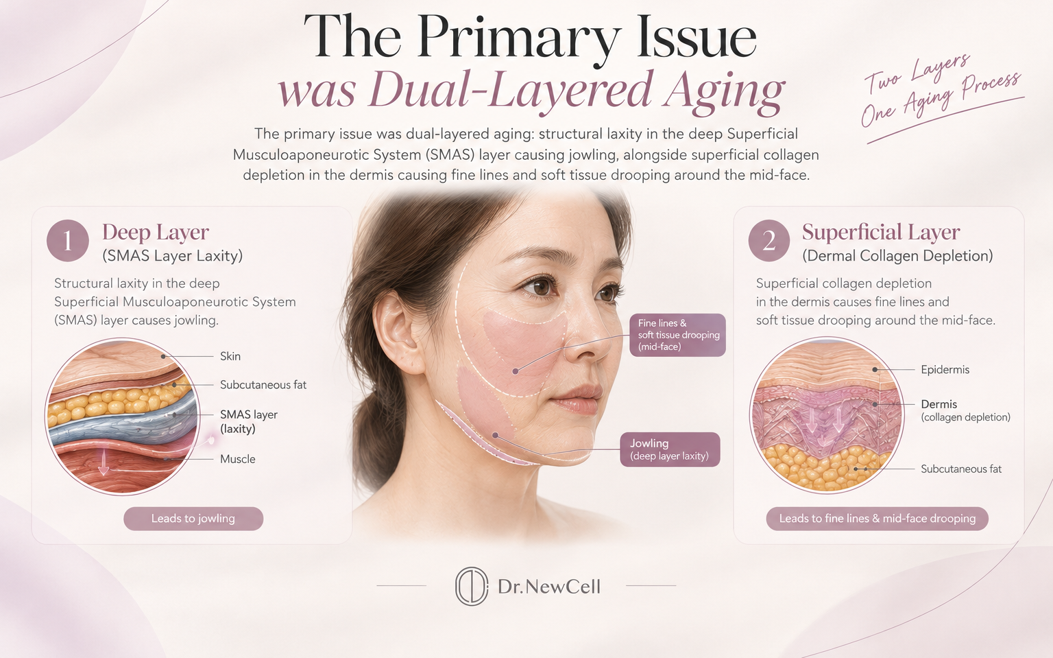The Ultimate Guide to Skin Tightening Treatments in Korea Top 5