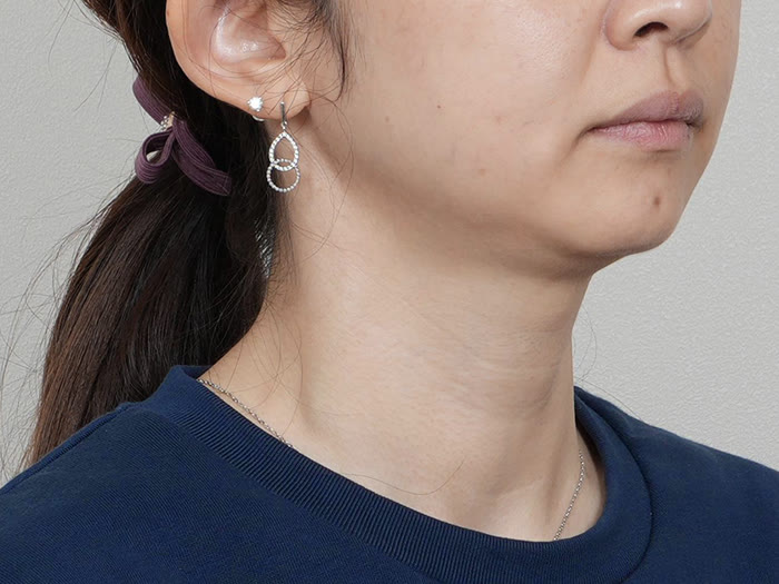 オールタイト リフティング施術前、30代女性の側面、あごのラインと二重あご