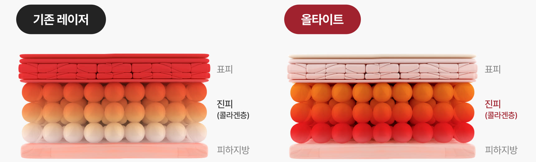 제조사 도판, 피부층 가열 비교: 기존 레이저는 표피가 가장 붉고 진피 아래로 갈수록 흰색으로 식는 반면, 올타이트는 표피는 옅고 진피 위부터 아래까지 붉게 데워진 모습
