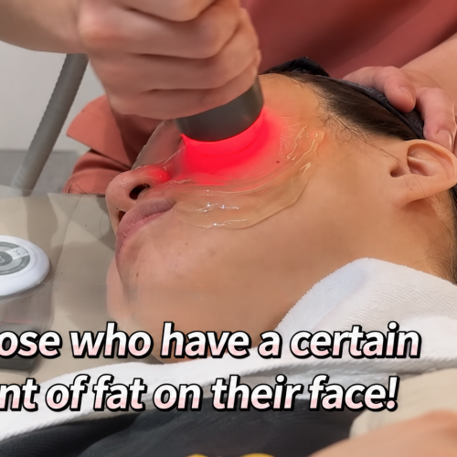 non surgical facelift Korea Eve Titan Lifting