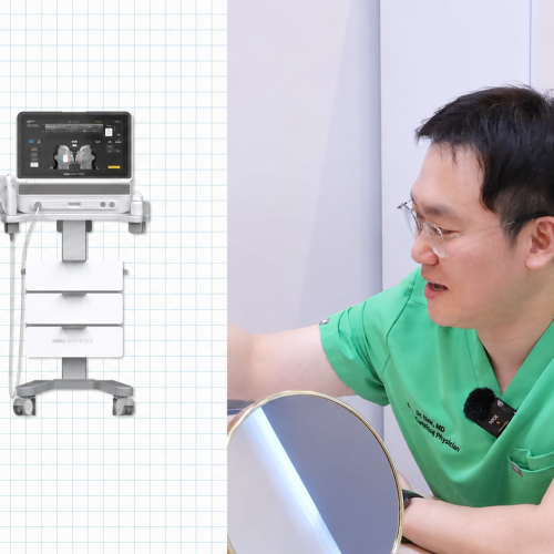 The Ultimate Ultrasound RF Combination : Ultherapy Prime and XERF